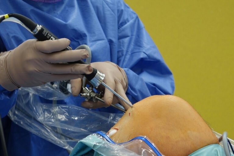 best slip disc surgeon in Delhi